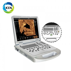 IN-AC60PLUS 3D 4D 5D Portable Notebook/Laptop Dopler Echo Wed Ultrasound Baby Scanner Machine