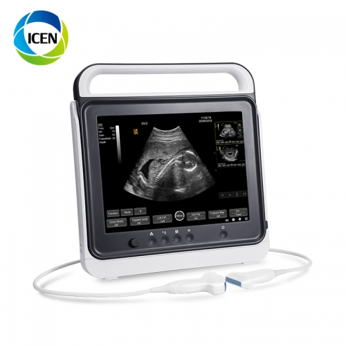 Scanner à ultrasons vétérinaire portable numérique médical YSB180V