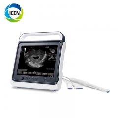 IN-A50A Portable ultrasound handheld device system ultrasound scanner machine medical ultrasound instruments