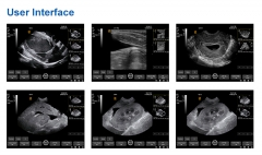 IN-A50A Portable ultrasound handheld device system ultrasound scanner machine medical ultrasound instruments