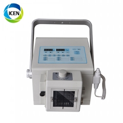IN-D100BY portable x-ray / digital x-ray machine prices / Portable high frequency x-ray unit