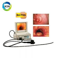 IN-PV68 Good quality Medical Devices Electronic Endoscope Video Gastroscope Colonoscope Animal Endoscope price