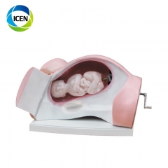 IN-403 Human Natural Size Magnified Uterus Model