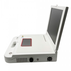 IN-GW605 Portable Hysteroscopy video endoscope camera System