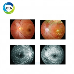 IN-VDER (Model B) Ophthalmology Examination Equipment Desk Top Medical Non Mydriatic Digital Eye Fundus Camera