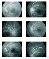 IN-VDER (Model B) Ophthalmology Examination Equipment Desk Top Medical Non Mydriatic Digital Eye Fundus Camera