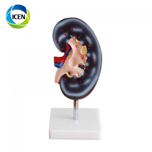 IN-310 Plastic Urinary System Model anatomical model for teaching