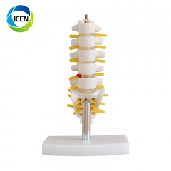 IN-103 medical teaching plastic spine model flexible spine model 4 pcs lumbar model