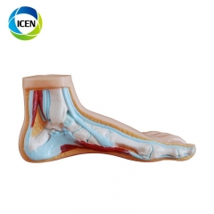 IN-311 PVC medical science teaching flat foot model model anatomical model