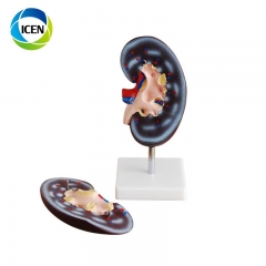 IN-310 Plastic Urinary System Model anatomical model for teaching