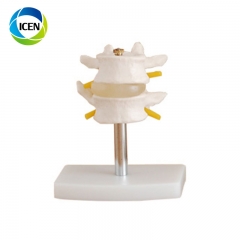 IN-103 medical teaching plastic spine model flexible spine model 4 pcs lumbar model