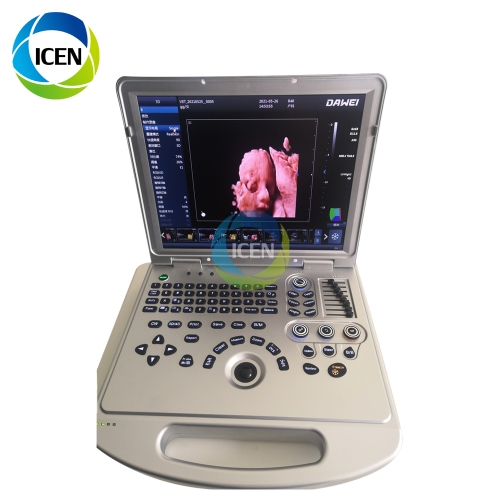 IN-AL5 PRO medical equipment 3D 5d laptop color doppler 4D ultrasound scanner usg machine price