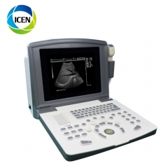 IN-A660 digital diagnostic skin ultrasound scanner machine doppler