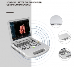 IN-AL5 PRO laptop color doppler 3D 4D 5d ultrasound medical scanner portable usg machine