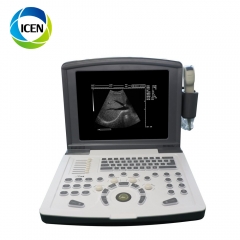 IN-A660 cheapest portable laptops ultrasound scanner machine for sale