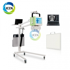 IN-D050 cheap digital mobile x-ray machine 100 ma portable radiology equipment price