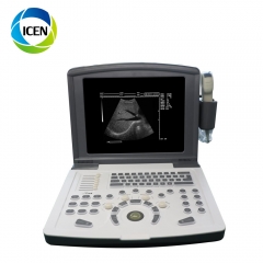 IN-A660 digital diagnostic skin ultrasound scanner machine doppler