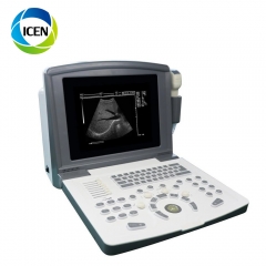 IN-A660 Clinical Application Full Digital Ultrasound Scanner Machine Price