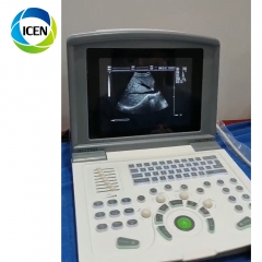 IN-A660 Clinical Application Full Digital Ultrasound Scanner Machine Price