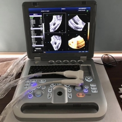IN-AB50C Handheld Ultrasound Machine 4d Color Doppler For Hospital