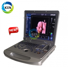 IN-AL5 PRO 3D 4D laptop color doppler portable pregnancy ultrasound 5d scanner usg machine