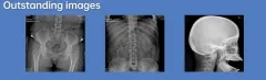 IN-D320 China radiographic digitization unit medical x-ray machine digital xray machine radiography