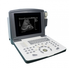 ICEN Good Price China Black White Ultrasound Portable Full Digital Diagnostic Ultrasound Scanner