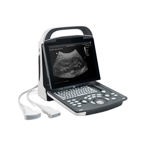 Mindray Dp-10 Portable Ultrasound Scanner Machine Digital B/w Ultrasound System