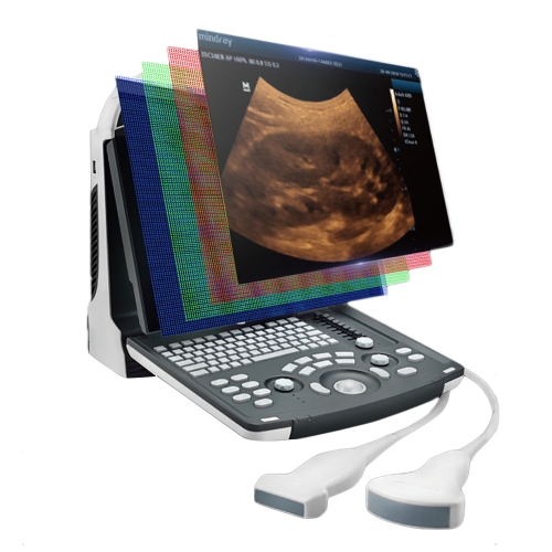 Original Mindray Dp30 Medical Ultrasound Instrument Dp-30 Portable Ultrasound Machine Dp 30 Black And White Other Ultrasonic