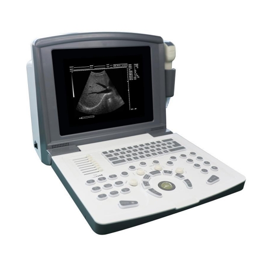 ICEN Cheap Portable Color Doppler Ultrasound Machines