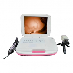 IN-G8000 Infrared Mammary Gland Diagnostic Instrument