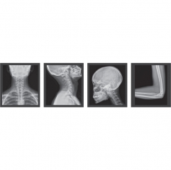 DigiEye 280 mindray Medical Radiology Xray Equipment High Frequency 400ma 32kw Digital Radiography X-ray Machine