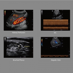 M6 Original Mindray M6 Ultrasonic Diagnostic Imaging System Color Doppler Ultrasound System M6