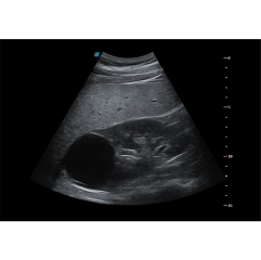 P25 sonoscape Jumper Jpd-100f New Design Handheld Ultrasound Baby Heartbeat Monitor Fetal Doppler Machine