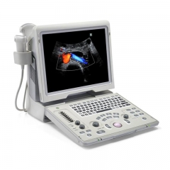 Z6 More Competitable Than Mindray M7 M9 Ultrasound Machine Color Doppler Mindray Z6