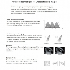 P25 sonoscape Mindray Ultrasound Full Digital Ultrasonic Diagnostic Imaging System B/w Portable Ultrasound Machine