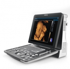 Z60 3d Portable Trolley Ultrasound Diagnostic Machine Price Similar To Mindray Ultrasound Machine