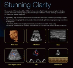 Ax3 Popular Design Edan Acclarix Ax3 Ultrasound Machine With Linear And Convex Probe