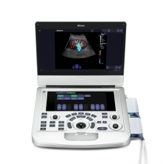 Ax3 Popular Design Edan Acclarix Ax3 Ultrasound Machine With Linear And Convex Probe