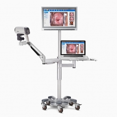 C6A Optical Mini Portable Digital Vagina Shenzhen Edan C6a Hd Video Colposcope Colposcopio Kolposkop For Gynecology Price Precio