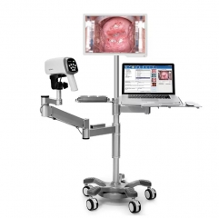 C6A Edan C3a & C6a Video Colposcope With Led Cold Lighting System Camera