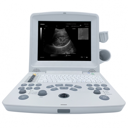 Edan DUS60 Portable Edan Ultrasound Machine Dus60 Vet/edan Dus60