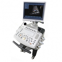 EDAN U2 Edan U2 Ultrasound Diagnostic System Cost-effective Trolley Ultrasound