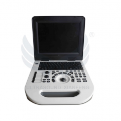 XianFeng E50 Top Laptop Color Doppler Ultrasound Diagnostic Instrument Medical Ultrasound Scanner 3d 4d Ultrasound Machine Color Doppler