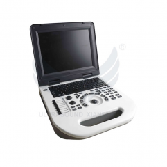 XianFeng E50 Portable Color Doppler Digital Pw Ultrasound Scanner Machine Doppler Ultrasound Diagnostic Ultrasound