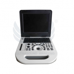 XianFeng E50 Factory Price Portable Color Doppler Ultrasound Scanner System Medical Ultrasound Instrument Laptop Ultrasound Probe