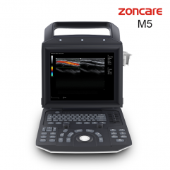 Zoncare M5 Medical Color Ultrasonic Diagnostic Apparatus Ultrasound Scanner Full Digital Trolley 4d Color Doppler Ultrasound For Hospital