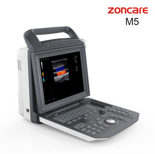 Zoncare M5 Medical Color Ultrasonic Diagnostic Apparatus Ultrasound Scanner Full Digital Trolley 4d Color Doppler Ultrasound For Hospital