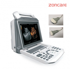 Zoncare i50 Color Doppler Ultrasound Diagnostic Instrument Mobile Full Digital Color Ultrasound Portable B-ultrasound Instrument Can