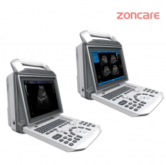 Zoncare i50 Laptop Medical Full Digital Color Doppler Portable Ultrasound System Diagnostic Scanner Machine 3d 4d For Hospital